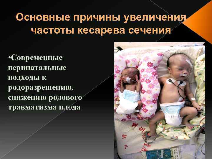 Основные причины увеличения частоты кесарева сечения • Современные перинатальные подходы к родоразрешению, снижению родового