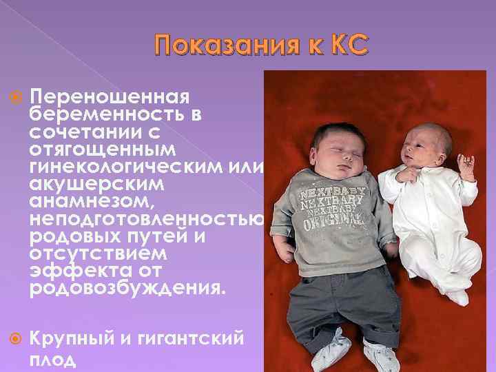 Показания к КС Переношенная беременность в сочетании с отягощенным гинекологическим или акушерским анамнезом, неподготовленностью