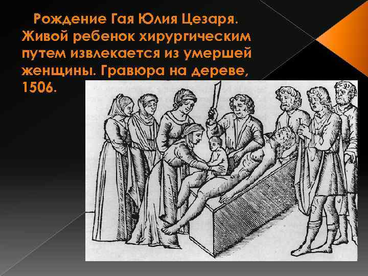 Рождение Гая Юлия Цезаря. Живой ребенок хирургическим путем извлекается из умершей женщины. Гравюра на