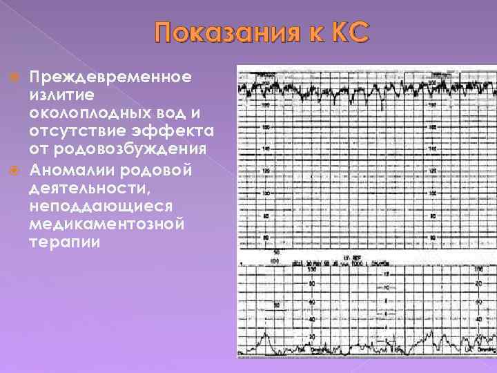 Показания к КС Преждевременное излитие околоплодных вод и отсутствие эффекта от родовозбуждения Аномалии родовой