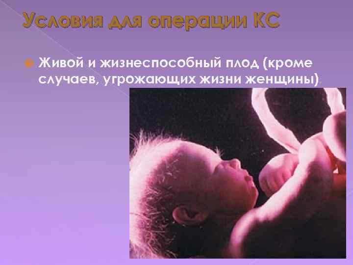 Условия для операции КС Живой и жизнеспособный плод (кроме случаев, угрожающих жизни женщины). 