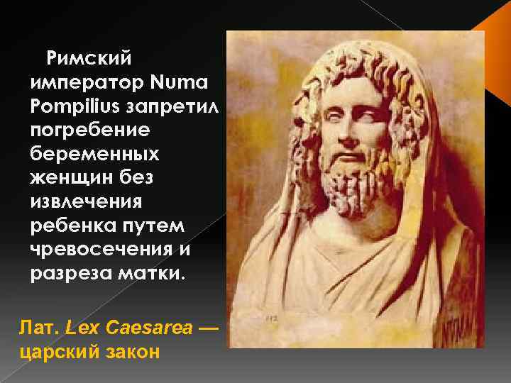 Римский император Numa Pompilius запретил погребение беременных женщин без извлечения ребенка путем чревосечения и