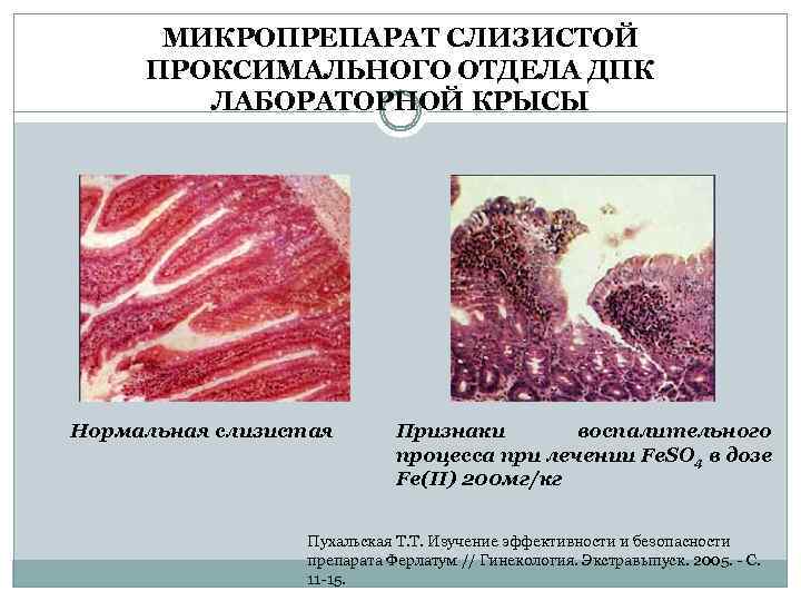 МИКРОПРЕПАРАТ СЛИЗИСТОЙ ПРОКСИМАЛЬНОГО ОТДЕЛА ДПК ЛАБОРАТОРНОЙ КРЫСЫ Нормальная слизистая Признаки воспалительного процесса при лечении