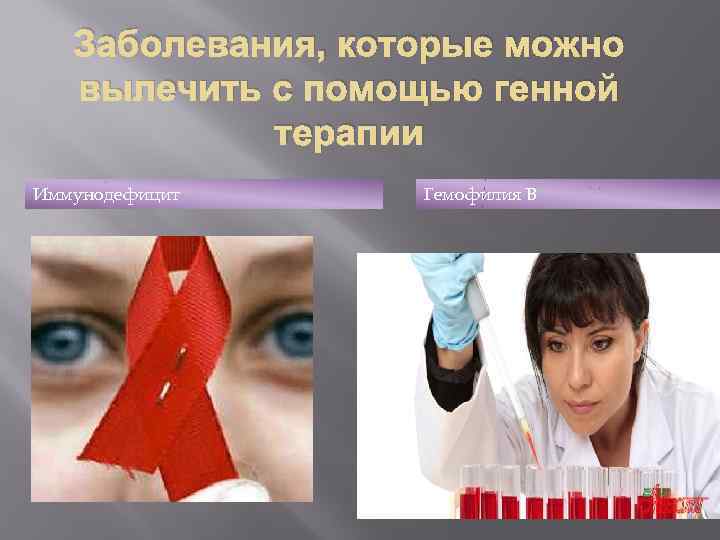 Заболевания, которые можно вылечить с помощью генной терапии Иммунодефицит Гемофилия В 