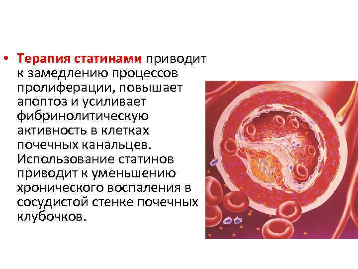  • Терапия статинами приводит к замедлению процессов пролиферации, повышает апоптоз и усиливает фибринолитическую