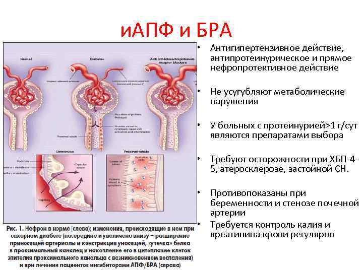 и. АПФ и БРА • Антигипертензивное действие, антипротеинурическое и прямое нефропротективное действие • Не