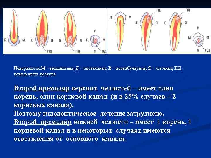 Поверхности: М – медиальная; Д – дистальная; В – вестибулярная; Я – язычная; ПД