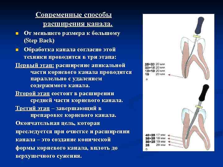 Современные способы расширения канала. От меньшего размера к большому (Step Back) n Обработка канала