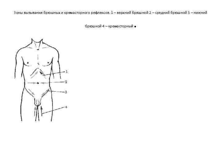 Зоны вызывания брюшных и кремасторного рефлексов. 1 – верхний брюшной 2 – средний брюшной