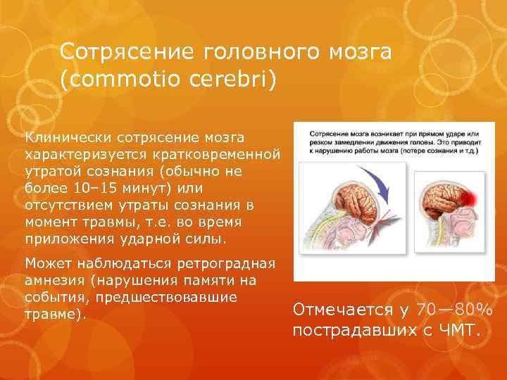 Сотрясение головного мозга (commotio cerebri) Клинически сотрясение мозга характеризуется кратковременной утратой сознания (обычно не