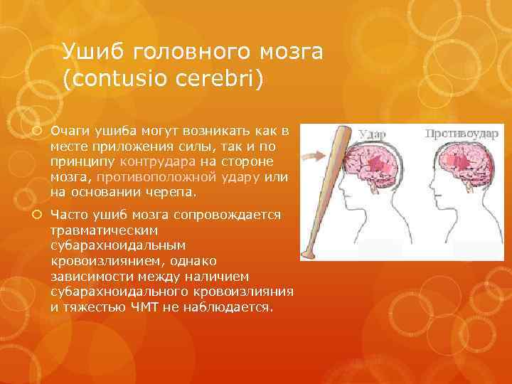 Ушиб головного мозга (contusio cerebri) Очаги ушиба могут возникать как в месте приложения силы,