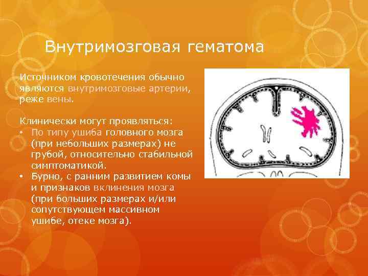 Внутримозговая гематома Источником кровотечения обычно являются внутримозговые артерии, реже вены. Клинически могут проявляться: •