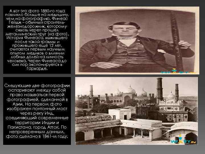 А вот это фото 1850 -го года повлияло больше на медицину, чем на фотографию.