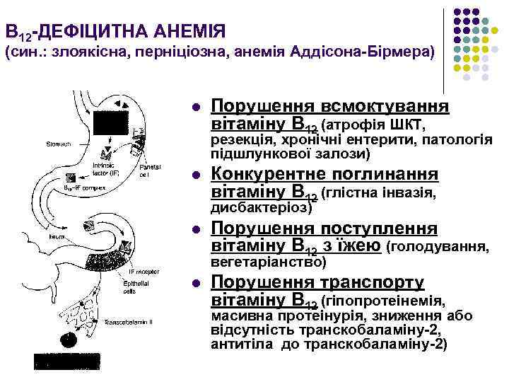 В 12 -ДЕФІЦИТНА АНЕМІЯ (син. : злоякісна, перніціозна, анемія Аддісона-Бірмера) l Порушення всмоктування вітаміну