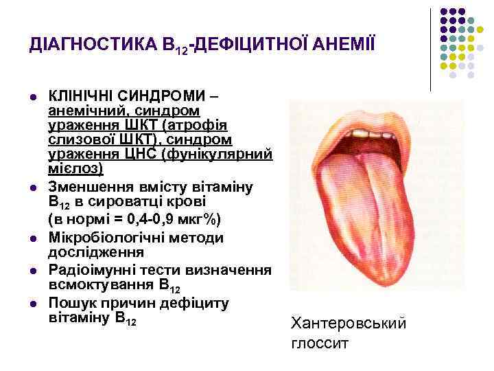 ДІАГНОСТИКА В 12 -ДЕФІЦИТНОЇ АНЕМІЇ l l l КЛІНІЧНІ СИНДРОМИ – анемічний, синдром ураження