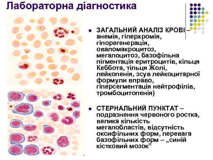 Лабораторна діагностика l ЗАГАЛЬНИЙ АНАЛІЗ КРОВІ – анемія, гіперхромія, гіпорегенерація, оваломакроцитоз, мегалоцитоз, базофільна пігментація