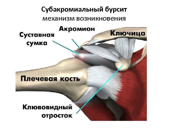 Боль отдает в правую ключицу