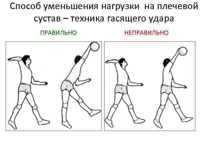 Характерная травма для баскетболистов и волейболистов. Профилактика травм в волейболе. Травматизм в волейболе. Профилактика травматизма в волейболе.