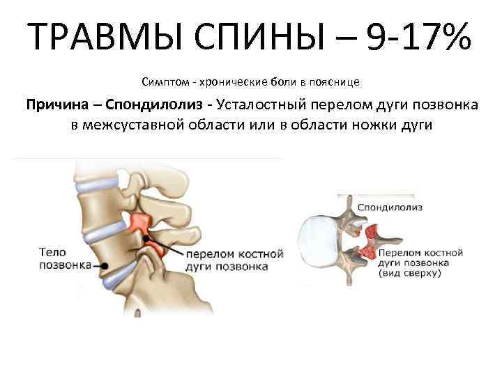 Травмы в волейболе презентация