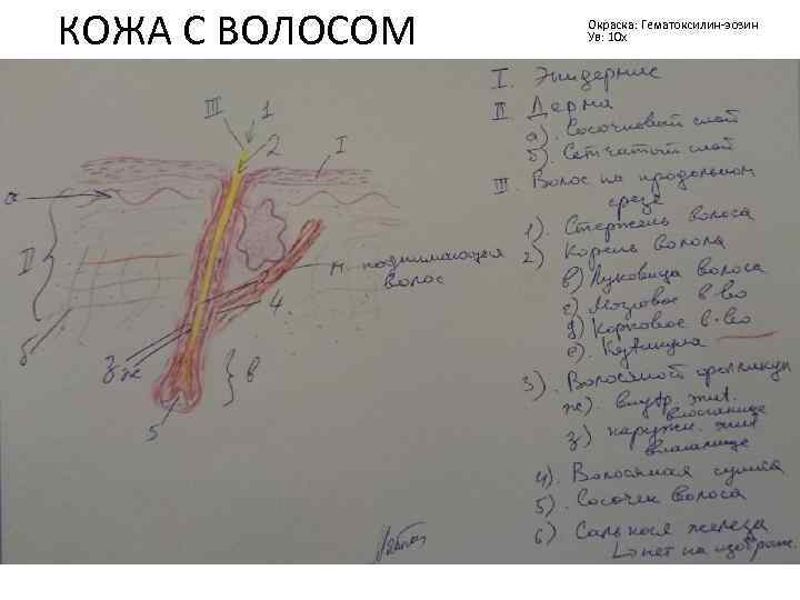 КОЖА С ВОЛОСОМ Окраска: Гематоксилин-эозин Ув: 10 х 