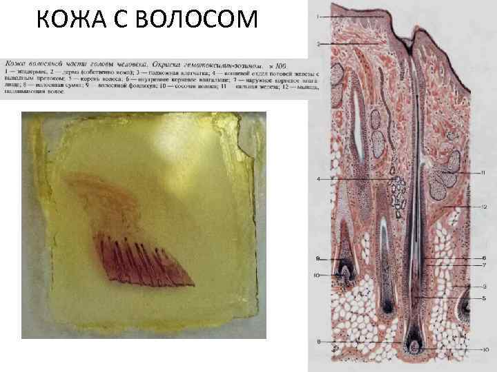 КОЖА С ВОЛОСОМ 