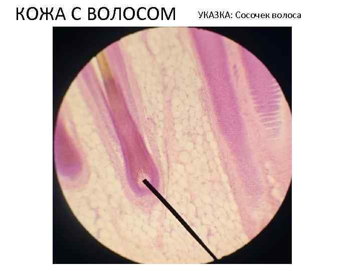 КОЖА С ВОЛОСОМ УКАЗКА: Сосочек волоса 