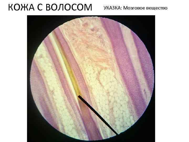 КОЖА С ВОЛОСОМ УКАЗКА: Мозговое вещество 