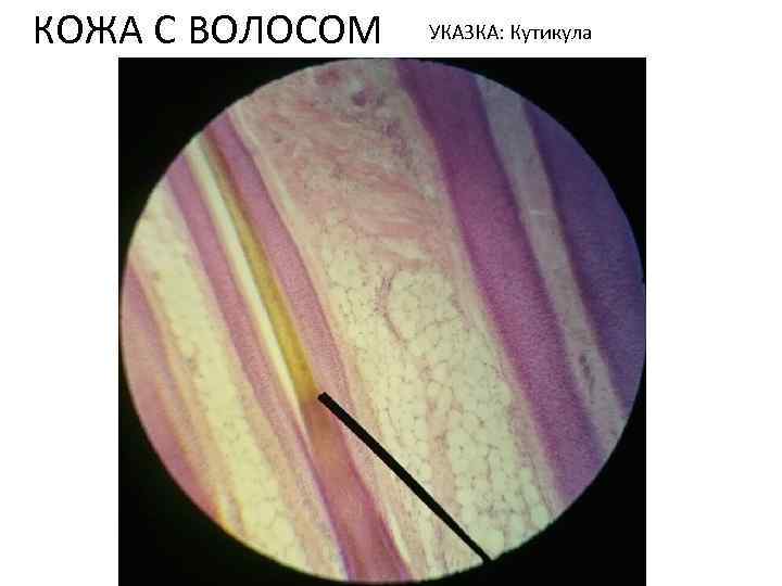 КОЖА С ВОЛОСОМ УКАЗКА: Кутикула 