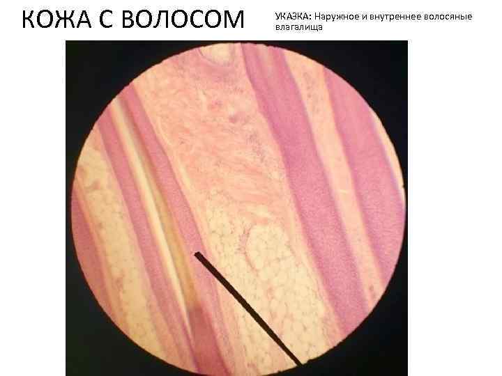 КОЖА С ВОЛОСОМ УКАЗКА: Наружное и внутреннее волосяные влагалища 