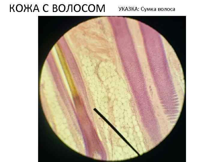 КОЖА С ВОЛОСОМ УКАЗКА: Сумка волоса 