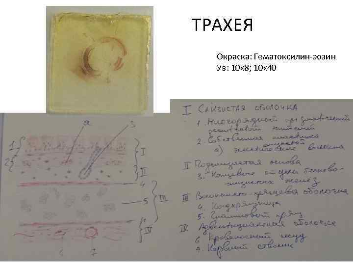 ТРАХЕЯ Окраска: Гематоксилин-эозин Ув: 10 х8; 10 х40 
