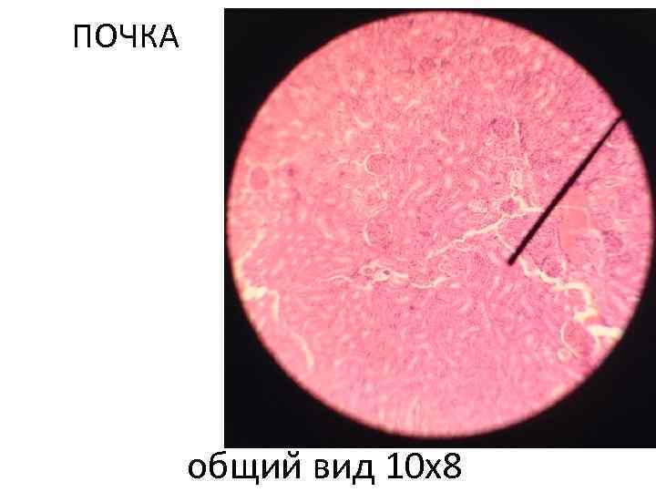 ПОЧКА общии вид 10 х8 