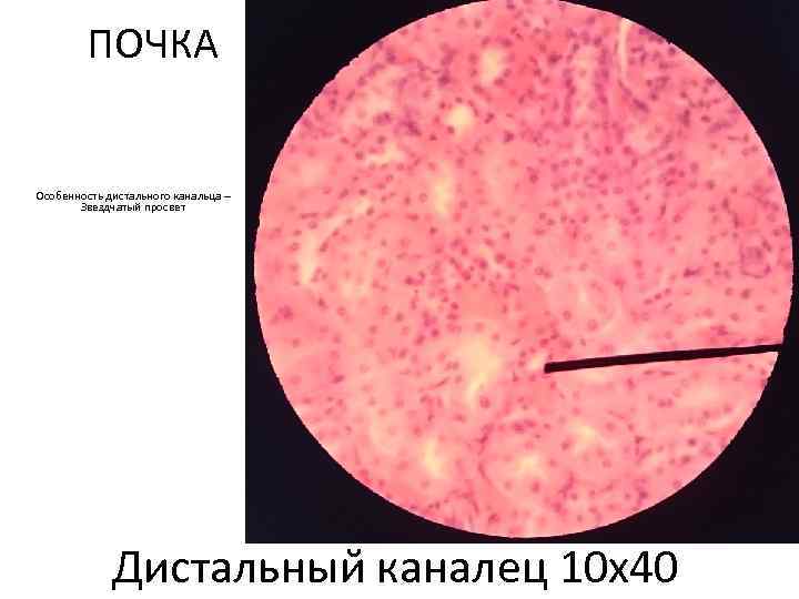 ПОЧКА Особенность дистального канальца – Звездчатый просвет Дистальныи каналец 10 х40 