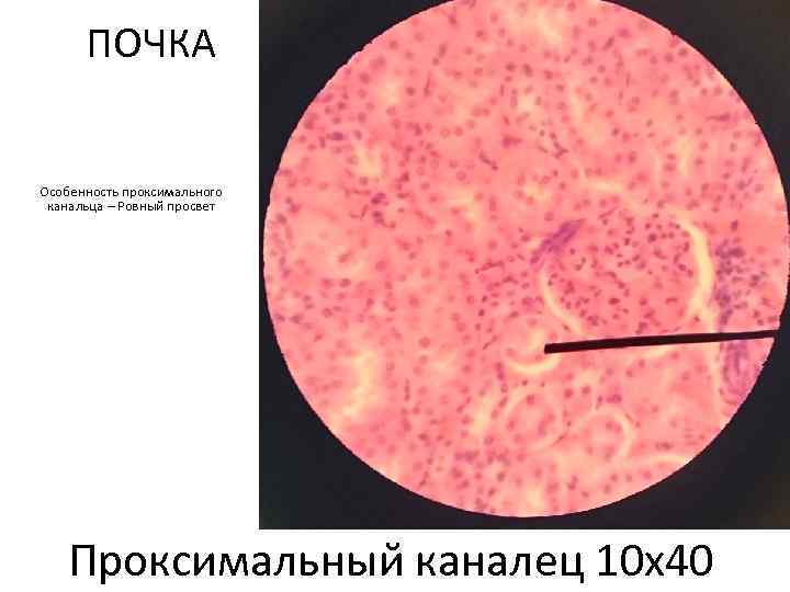 ПОЧКА Особенность проксимального канальца – Ровный просвет Проксимальныи каналец 10 х40 