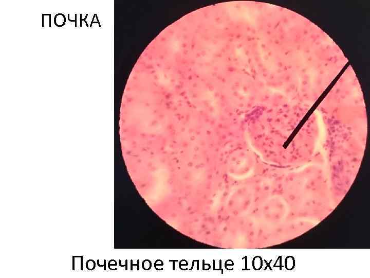 ПОЧКА Почечное тельце 10 х40 