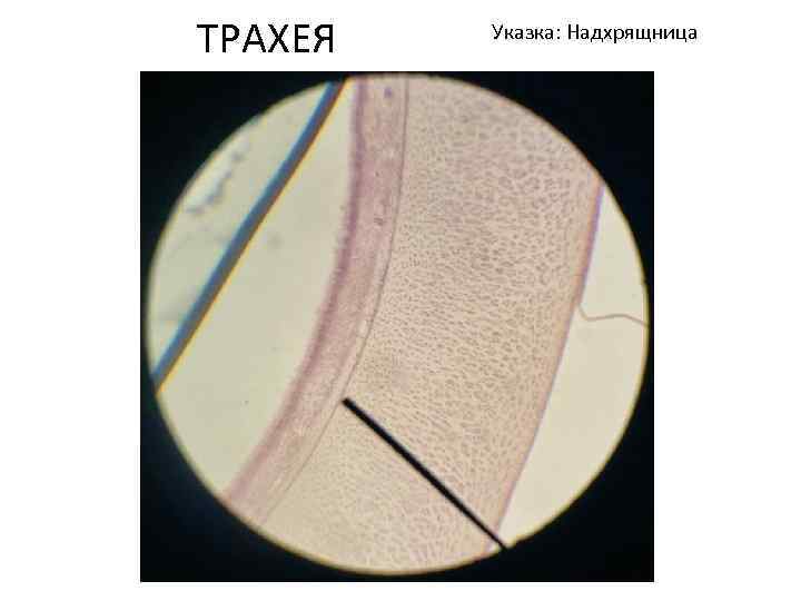 ТРАХЕЯ Указка: Надхрящница 