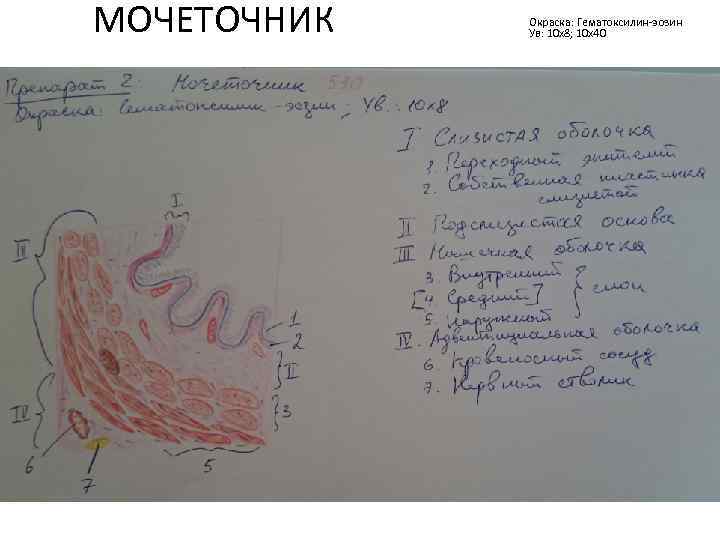 МОЧЕТОЧНИК Окраска: Гематоксилин-эозин Ув: 10 х8; 10 х40 