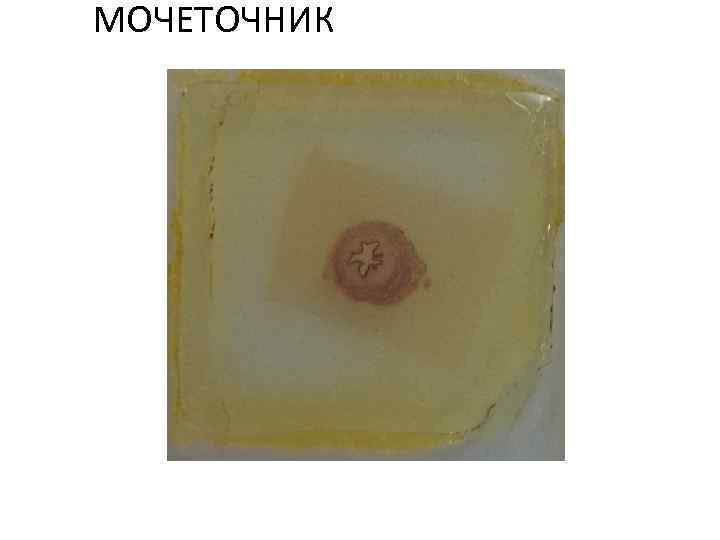 МОЧЕТОЧНИК 