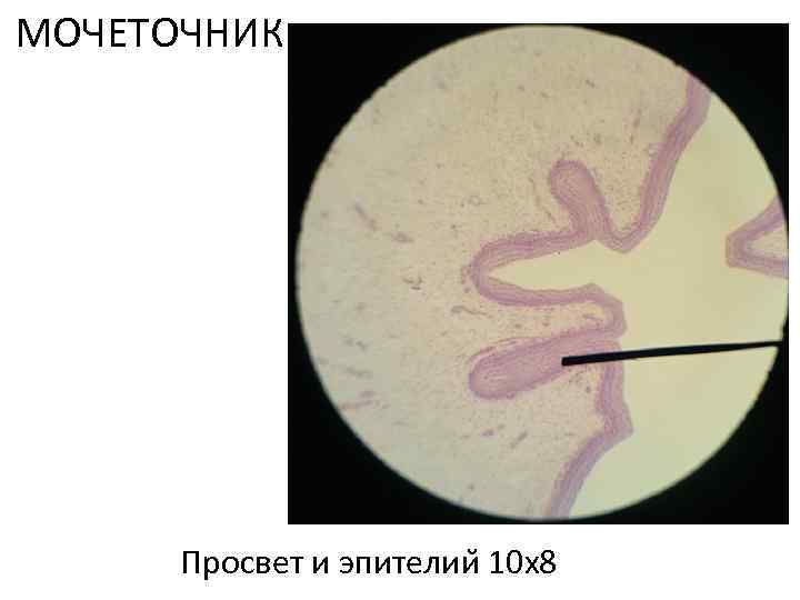 МОЧЕТОЧНИК Просвет и эпителии 10 х8 