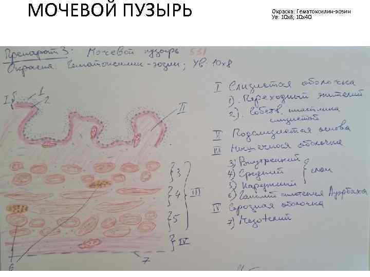МОЧЕВОЙ ПУЗЫРЬ Окраска: Гематоксилин-эозин Ув: 10 х8; 10 х40 