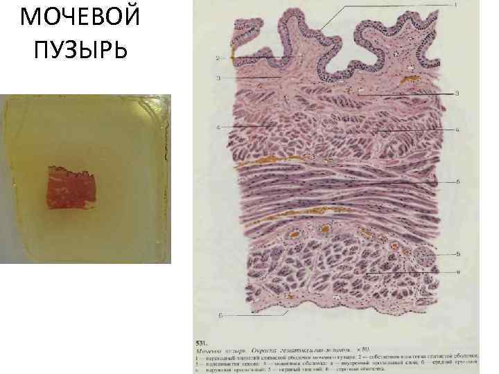 МОЧЕВОЙ ПУЗЫРЬ 