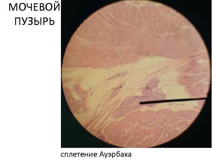 МОЧЕВОЙ ПУЗЫРЬ сплетение Ауэрбаха 