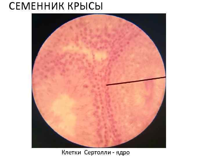 СЕМЕННИК КРЫСЫ Клетки Сертолли - ядро 
