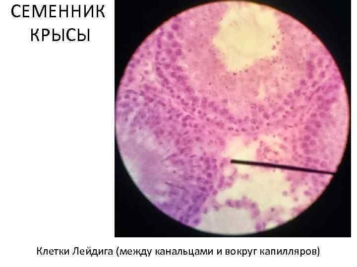 СЕМЕННИК КРЫСЫ Клетки Леи дига (между канальцами и вокруг капилляров) 