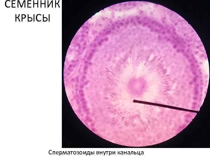 СЕМЕННИК КРЫСЫ Сперматозоиды внутри канальца 