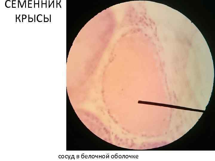 СЕМЕННИК КРЫСЫ сосуд в белочнои оболочке 