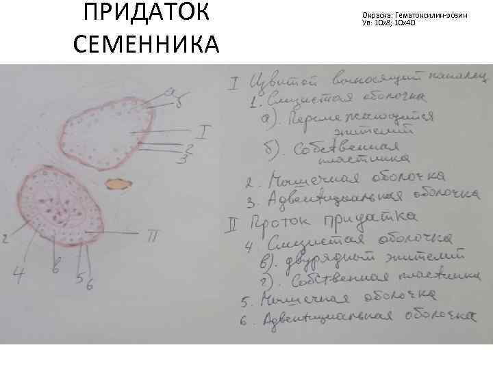 ПРИДАТОК СЕМЕННИКА Окраска: Гематоксилин-эозин Ув: 10 х8; 10 х40 