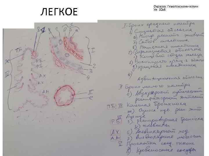 ЛЕГКОЕ Окраска: Гематоксилин-эозин Ув: 10 х8 