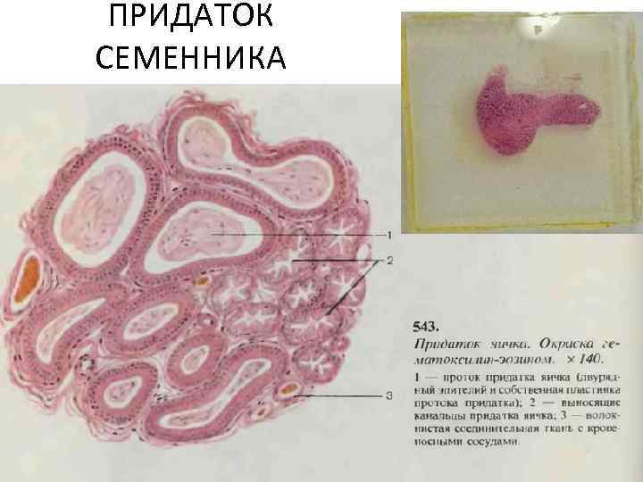 Придаток семенника фото