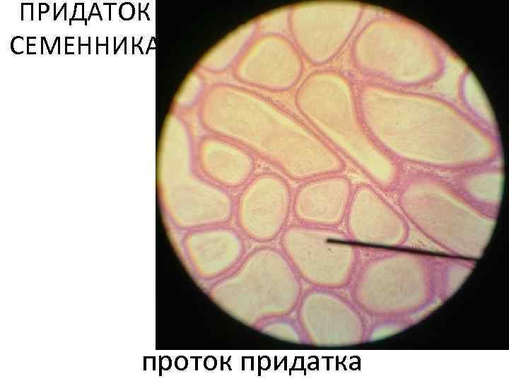 ПРИДАТОК СЕМЕННИКА проток придатка 